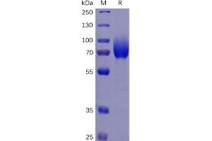 Human CSF1R Protein, His Tag on SDS-PAGE under reducing condition. (CSF1R Protein (His tag))