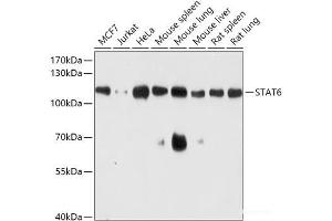 Western blot analysis of extracts of various cell lines using STAT6 Polyclonal Antibody at dilution of 1:1000.