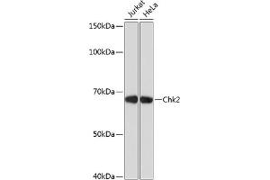 Western blot analysis of extracts of various cell lines, using Chk2 antibody (ABIN7266294) at 1:1000 dilution. (CHEK2 抗体)