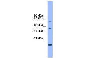 WB Suggested Anti-NOTCH4 Antibody Titration:  0. (NOTCH4 抗体  (C-Term))