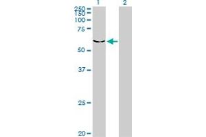 Western Blot analysis of DYRK2 expression in transfected 293T cell line by DYRK2 monoclonal antibody (M01), clone 3G5. (DYRK2 抗体  (AA 1-100))