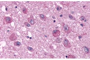 Anti-PPYR1 antibody  ABIN1049234 IHC staining of human brain. (NPY4R 抗体  (Extracellular Domain))