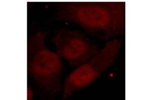 Image no. 2 for anti-Histone Deacetylase 2 (HDAC2) (pSer394) antibody (ABIN319237) (HDAC2 抗体  (pSer394))
