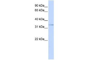 WB Suggested Anti-ETV3L Antibody Titration:  0. (ETV3L 抗体  (C-Term))