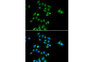 Immunofluorescence analysis of U2OS cells using PHC3 antibody.