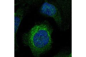 Immunofluorescent staining of U-2 OS with LIMCH1 polyclonal antibody  (Green) shows positivity in cytoplasm. (LIMCH1 抗体)