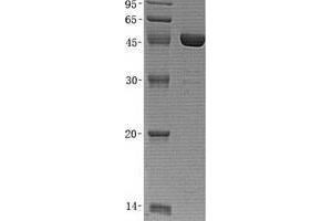 Western Blotting (WB) image for Ubiquitin Specific Peptidase 14 (USP14) (Transcript Variant 2) protein (His tag) (ABIN2735095)