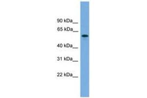Image no. 1 for anti-MTOR associated protein, eak-7 homolog (MEAK7) (C-Term) antibody (ABIN6746516) (KIAA1609 抗体  (C-Term))