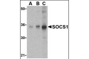 Western blot analysis of SOCS1 in Human spleen cell lysate with this product at (A) 1, (B) 2 and (C) 4 μg/ml. (SOCS1 抗体  (N-Term))