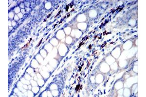 Immunohistochemical analysis of paraffin-embedded colon tissues using IGLC2 mouse mAb with DAB staining. (IGLC2 抗体  (AA 1-106))