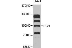 Western blot analysis of extracts of BT-474 cells, using PGR antibody. (Progesterone Receptor 抗体)