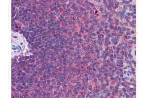 Anti-MDA5 antibody IHC of human spleen. (IFIH1 抗体  (AA 612-661))
