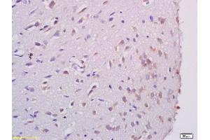 Immunohistochemistry (IHC) image for anti-Apoptosis Antagonizing Transcription Factor (AATF) (AA 451-560) antibody (ABIN673689)
