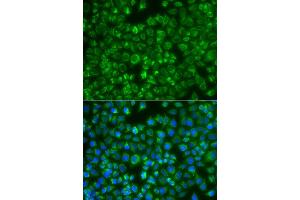 Immunofluorescence analysis of A549 cell using MTMR4 antibody. (MTMR4 抗体)