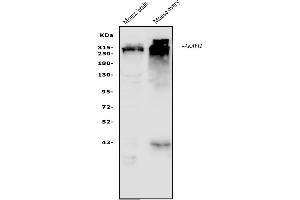 Western blot analysis of AKAP12 using anti-AKAP12 antibody (ABIN7601563). (AKAP12 抗体  (AA 387-1620))