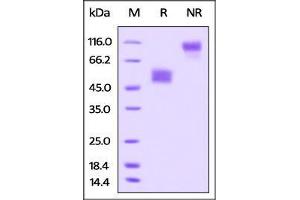 SDS-PAGE (SDS) image for T Cell Immunoreceptor with Ig and ITIM Domains (TIGIT) (AA 17-138) (Active) protein (Fc Tag) (ABIN4949213)