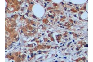 Immunohistochemistry (IHC) image for anti-Stathmin 1 (STMN1) (AA 2-149) antibody (ABIN7435226)