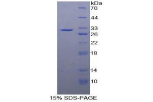 SDS-PAGE analysis of Human Cadherin 5 Protein. (Cadherin 5 Protein (CDH5))