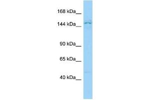 Host: Rabbit Target Name: PPP1R9A Sample Type: Jurkat Whole Cell lysates Antibody Dilution: 1. (PPP1R9A 抗体  (N-Term))