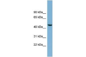 Human OVCAR-3; WB Suggested Anti-ALPPL2 Antibody Titration: 0. (ALPPL2 抗体  (Middle Region))