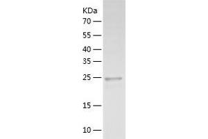 FGFBP1 Protein (AA 24-234) (His tag)