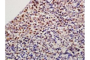 Formalin-fixed and paraffin embedded mouse fetal liver labeled with Rabbit Anti-TXNDC9 Polyclonal Antibody, Unconjugated  at 1:200 followed by conjugation to the secondary antibody and DAB staining (TXNDC9 抗体  (AA 182-226))