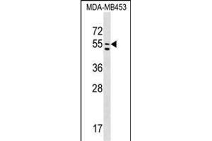 PTDSS1 Antibody (C-term) (ABIN1537254 and ABIN2848773) western blot analysis in MDA-M cell line lysates (35 μg/lane). (PTDSS1 抗体  (C-Term))
