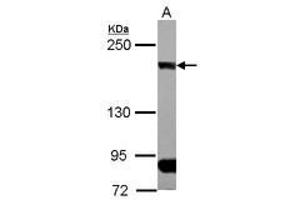 Image no. 1 for anti-CAP-GLY Domain Containing Linker Protein 1 (CLIP1) (N-Term) antibody (ABIN1494006) (CLIP1 抗体  (N-Term))