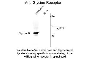 Glycine Receptor (GRD) (N-Term) 抗体