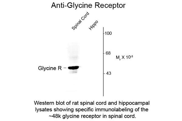 Glycine Receptor (GRD) (N-Term) 抗体