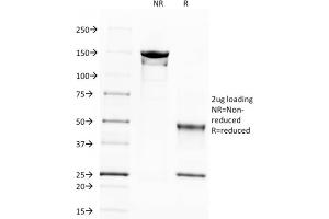 SDS-PAGE (SDS) image for anti-Spectrin, Beta, Non-erythrocytic 2 (SPTBN2) (AA 356-475) antibody (ABIN6940652)