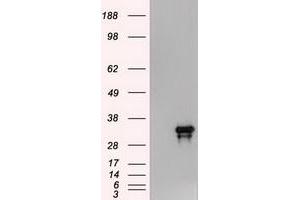 HEK293T cells were transfected with the pCMV6-ENTRY control (Left lane) or pCMV6-ENTRY Noggin (RC205020) (Right lane) cDNA for 48 hrs and lysed. (NOG 抗体  (AA 28-232))