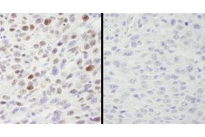 Immunohistochemistry (IHC) image for anti-Minichromosome Maintenance Complex Component 2 (MCM2) (pSer40), (pSer41) antibody (ABIN7448650) (MCM2 抗体  (pSer40, pSer41))