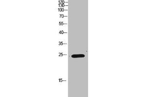 Western Blot analysis of HEPG2 cells using Antibody diluted at 1000. (IMP3 抗体  (AA 135-184))