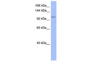 MSH4 antibody used at 1 ug/ml to detect target protein. (MSH4 抗体)
