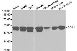 Western blot analysis of extracts of various cell lines, using SGK1 antibody (ABIN5970402) at 1/1000 dilution. (SGK1 抗体)