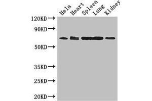 Western Blot Positive WB detected in: Hela whole cell lysate, Mouse heart tissue, Mouse spleen tissue, Mouse lung tissue, Mouse kidney tissue All lanes: ENTPD7 antibody at 2. (ENTPD7 抗体  (AA 51-350))