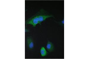 IF analysis of 14-3-3 sigma using anti-14-3-3 sigma antibody (ABIN5693156).