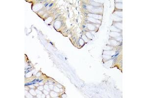 Immunohistochemistry of paraffin-embedded human colon using LRG1 antibody (ABIN5975207) at dilution of 1/100 (40x lens). (LRG1 抗体)
