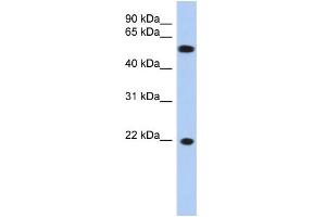 WB Suggested Anti-CRYGC Antibody Titration: 0. (CRYGC 抗体  (Middle Region))