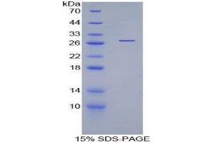 SDS-PAGE analysis of Human Myocilin Protein. (MYOC 蛋白)