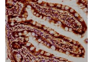 IHC image of ABIN7168857 diluted at 1:400 and staining in paraffin-embedded human small intestine tissue performed on a Leica BondTM system. (Septin 11 抗体  (AA 237-429))