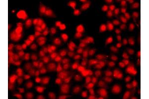 Immunofluorescence analysis of A549 cell using THAP1 antibody. (THAP1 抗体)