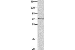 Western blot analysis of Mouse eye tissue, using MUC20 Polyclonal Antibody at dilution of 1:1400 (MUC20 抗体)