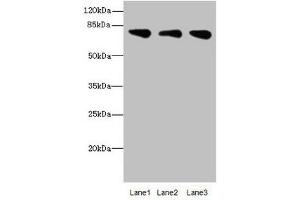 Western blot All lanes: ACSS2antibody at 2. (ACSS2 抗体  (AA 462-701))