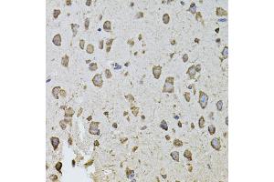 Immunohistochemistry of paraffin-embedded mouse brain using FGF2 antibody (ABIN1872685) at dilution of 1:100 (40x lens). (FGF2 抗体)