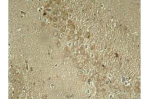 Immunohistochemical staining of rat hippocampal region tissue from a model with Alzheimer using MAPT (phospho S262) polyclonal antibody  under 1:50-1:100 dilution. (MAPT 抗体  (pSer262))