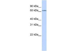 TRMT5 antibody used at 1 ug/ml to detect target protein.