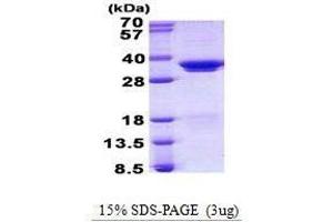 Figure annotation denotes ug of protein loaded and % gel used. (SRSF1 蛋白)