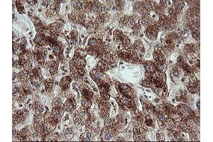 Image no. 9 for anti-Tripartite Motif Containing 44 (TRIM44) antibody (ABIN1501505)